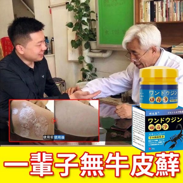 【日本醫學院韓教授推薦頑毒凈草本抑菌軟膏】 先止癢 後殺菌 好後200%不再犯,中藥調製,0%添加,治牛皮廯、銀屑病、手足廯等,皮膚真菌疾病! 【日本醫學院韓教授推薦頑毒凈草本抑菌軟膏】 先止癢 後殺菌 好後200%不再犯,中藥調製,0%添加,治牛皮廯、銀屑病、手足廯等,皮膚真菌疾病!